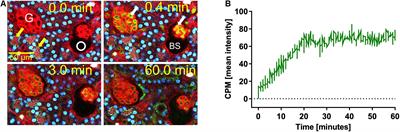 Live Imaging of Calciprotein Particle Clearance and Receptor Mediated Uptake: Role of Calciprotein Monomers